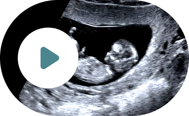 fecundacion-in-vitro-video-pgt-a